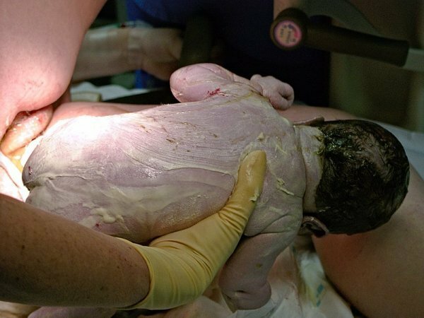 baby with vernix